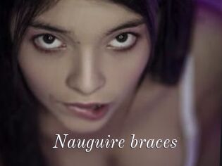 Nauguire_braces